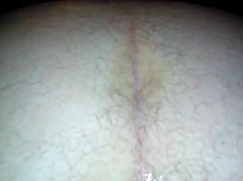 King Cock Gape
