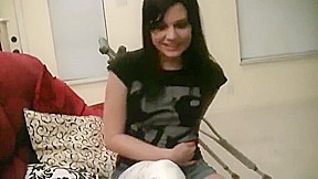 Leg Cast