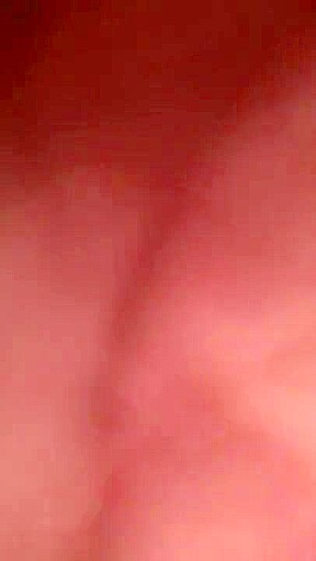 Pussy farting