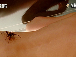 See The Craziest Anatomy Awards Nude Scenes - Mr Skin