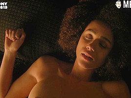 See The Craziest Anatomy Awards Nude Scenes - Mr Skin