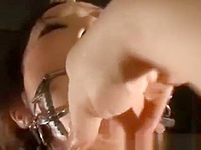 open mouth gag